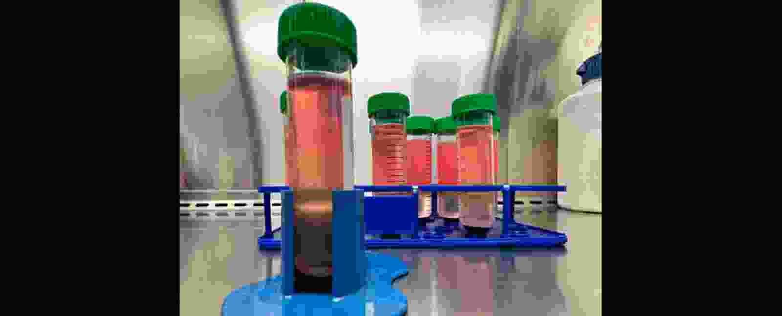 Leukocyte Slider Image.png