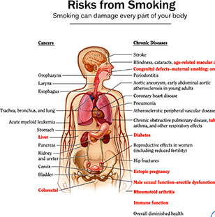 health consequences of smoking