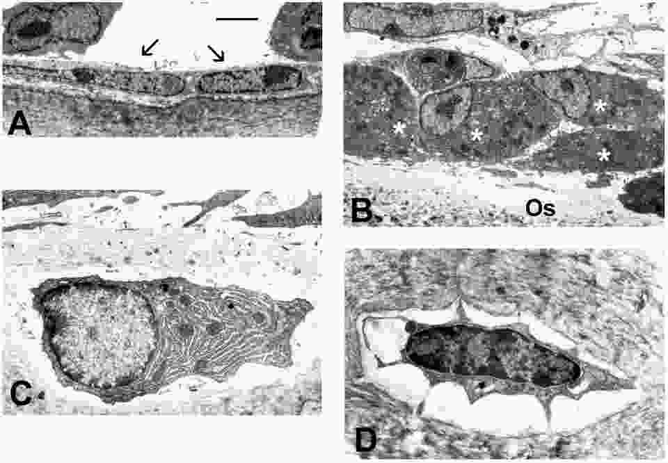 TEM images show A) flat, inactive bone lining cells which cover bone surfaces when bone formation is not activated. B) shows active, plump osteoblasts actively synthesizing bone and depositing bone matrix (osteoid: OS) beneath them. C) Some osteoblasts become encased within the bone matrix and are then called osteocytes. The abundant endoplasmic reticulum indicates that this is an osteogenic osteocyte still actively synthesizing bone. D) And osteolytic osteocyte has begun to degrade the surrounding bone as part of the remodeling process. (see Odgren, PR, et al. 2004. “Bone Structure,” in Encyclopedia of Endocrine Diseases, L Martini, ed. Vol. 1:392-400. Academic Press, San Diego.)