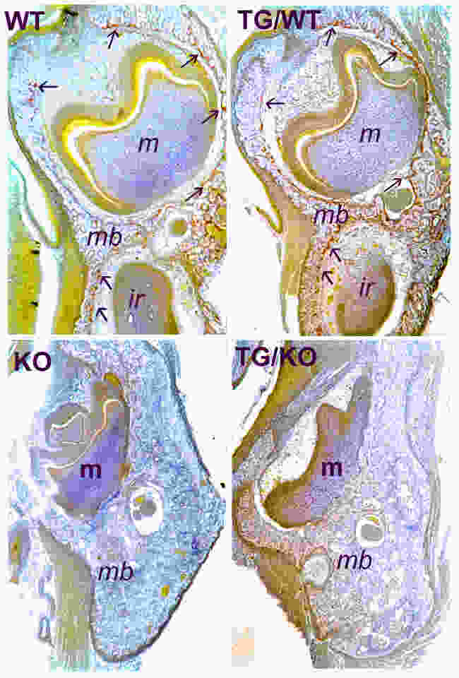 Sections of 3-day old mouse mandibles, TRANCE (RANKL) knockout (KO) and transgenic (TG) rescue compared to wild type (WT). Glycol methacrylate sections stained red for TRAP enzyme (osteoclasts) and counterstained with toluidine blue. Areas surrounding developing teeth are rich in osteoclasts to allow for tooth expansion (arrows). TG rescue under lymphocyte promoter did not supply TRANCE in the jaws, preventing tooth eruption. (see Odgren, PR, et al. 2003. Connective Tissue Research 44(suppl 1):264-271).
