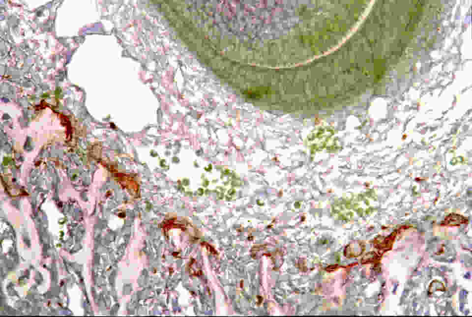 Three day old mouse mandible shows growing incisor root – greenish crescent, upper right, surrounded by the dental follicle of loose connective tissue. Outside that are mandibular bone trabeculae with TRAP (red) stained osteoclasts perched on their ends actively resorbing bone to make space for the rapidly growing tooth. Glycol methacrylate section counterstained with toluidine blue. (see Odgren, et al., Connective Tissue Research 44(suppl 1):264-271).