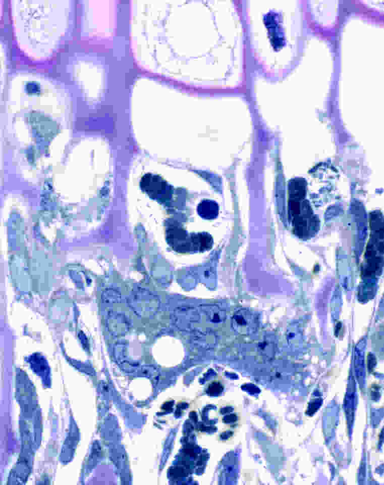 Invasion of growth cartilage by bone. 2 μm section of Epon embedded proximal rat tibial chondroosseous junction 4 weeks old) stained with toluidine blue. A multinucleated osteoclast (also called chondroclast at this location) with about 11 nuclei visible, along with prominent vacuoles, is resorbing the pinkish colored longitudinal septa of the growth plate. Blood vessels, chondrocytes, and osteoblasts are also visible. (see Gartland, A, et al. 2009. American Journal of Pathology 175(6)).