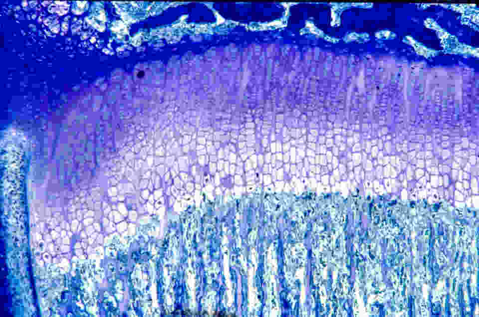 During long bone growth, the cartilage growth plate is the center of elongation. It is highly organized, with zones of resting, proliferating, and hypertrophic chondrocytes. Proximal tibia of 4-week-old normal rat stained with toluidine blue (see Devraj et al., 2004. Connective Tissue Research 45:1-10).