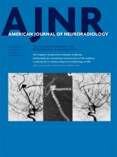 Hemodynamic Characteristics of Ruptured and Unruptured Multiple Aneurysms at Mirror and Ipsilateral Locations