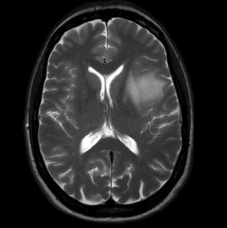 Advanced MRI Center brain