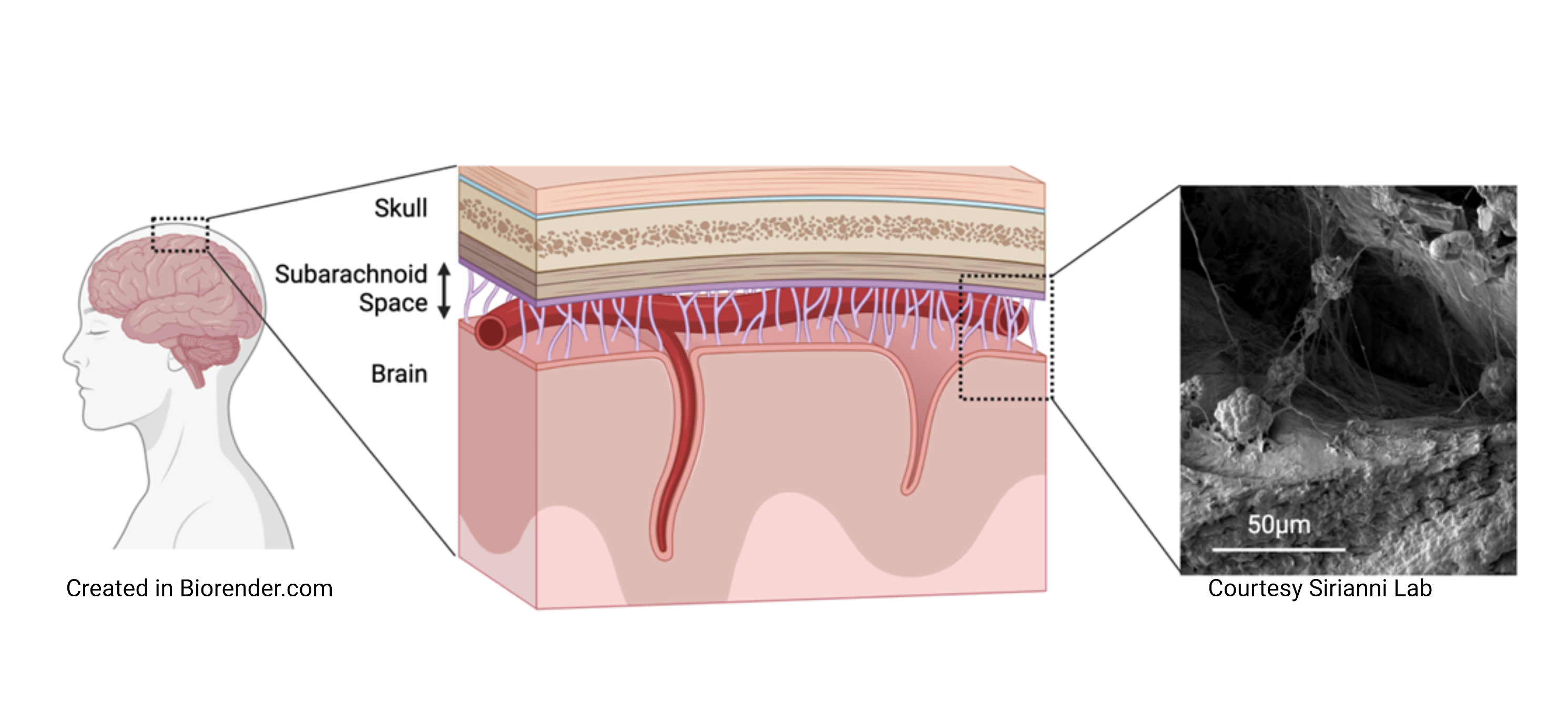 Diagram of subarachnoid space