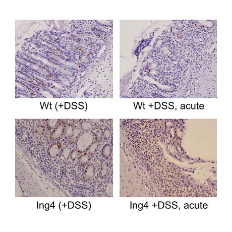 Modelling inflammatory bowel disease in Ing4-null mice.
