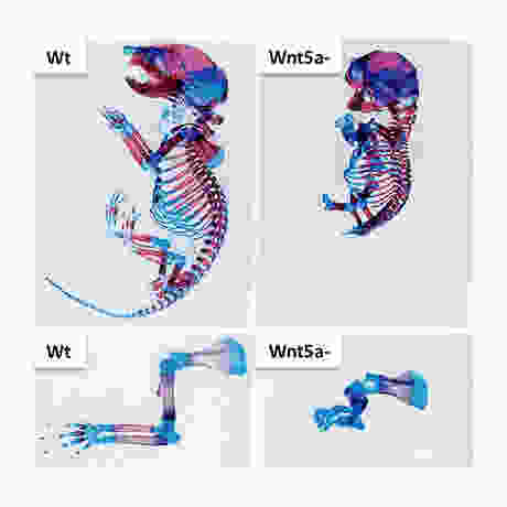 Loss of Wnt5a induces skeletal defects.