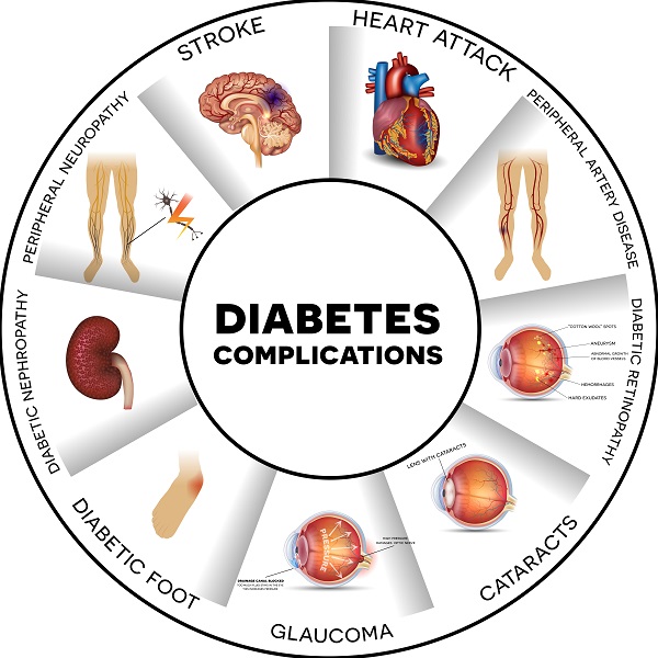 Diabetes-Complications