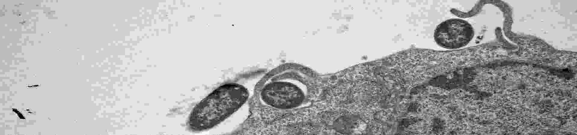 macrophage-eating-Y-pestis-(kate-fitzgerald's-conflicted-copy-2016-08-16).png