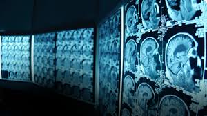 Image of MRIs
