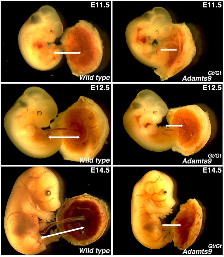 Research - Umbilical cord development and physiology