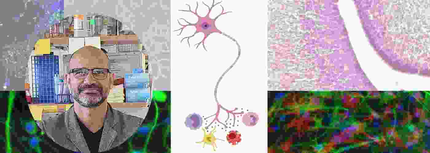 Neuroimmune interactions laboratory neuron images relative to study