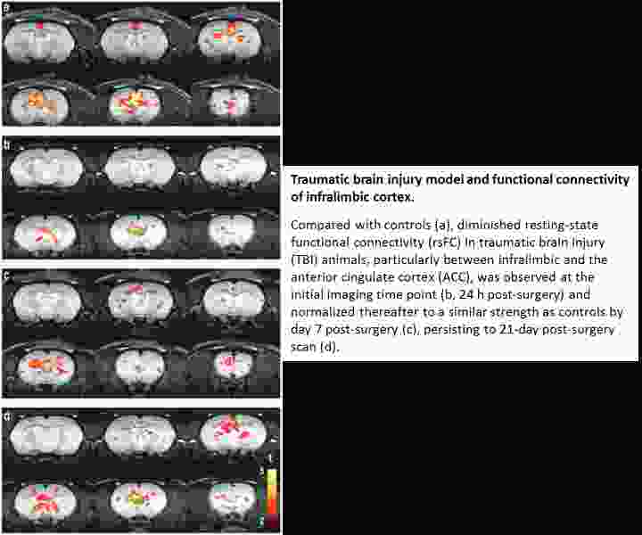 Traumatic brain injury model