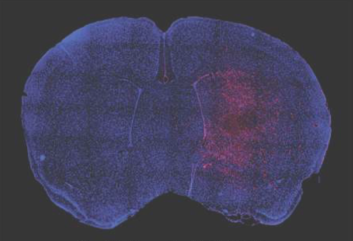 Mouse brain section